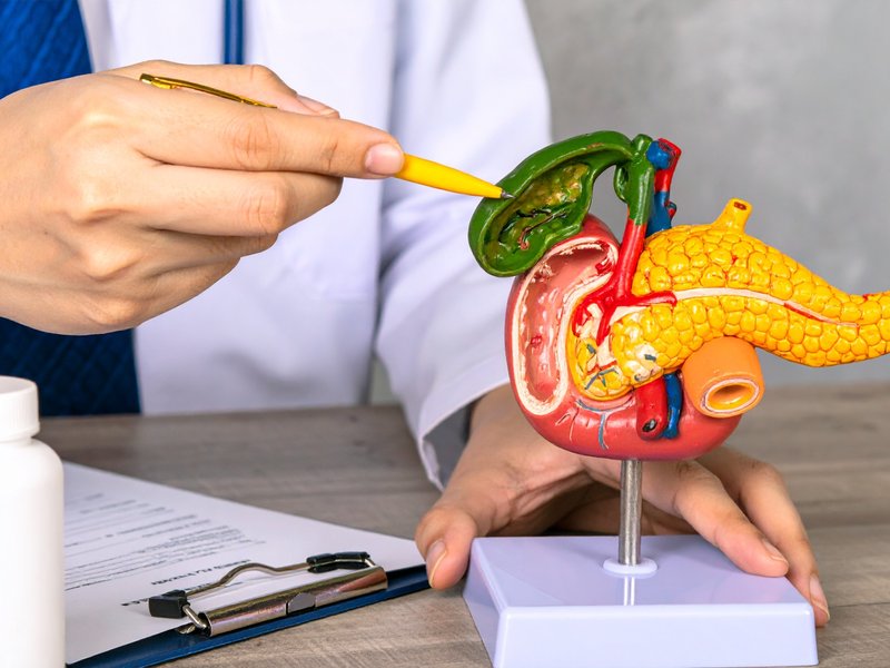 गलत लाइफस्टाइल और खानपान बिगाड़ सकता है सेहत, पथरी का बढ़ता है खतरा